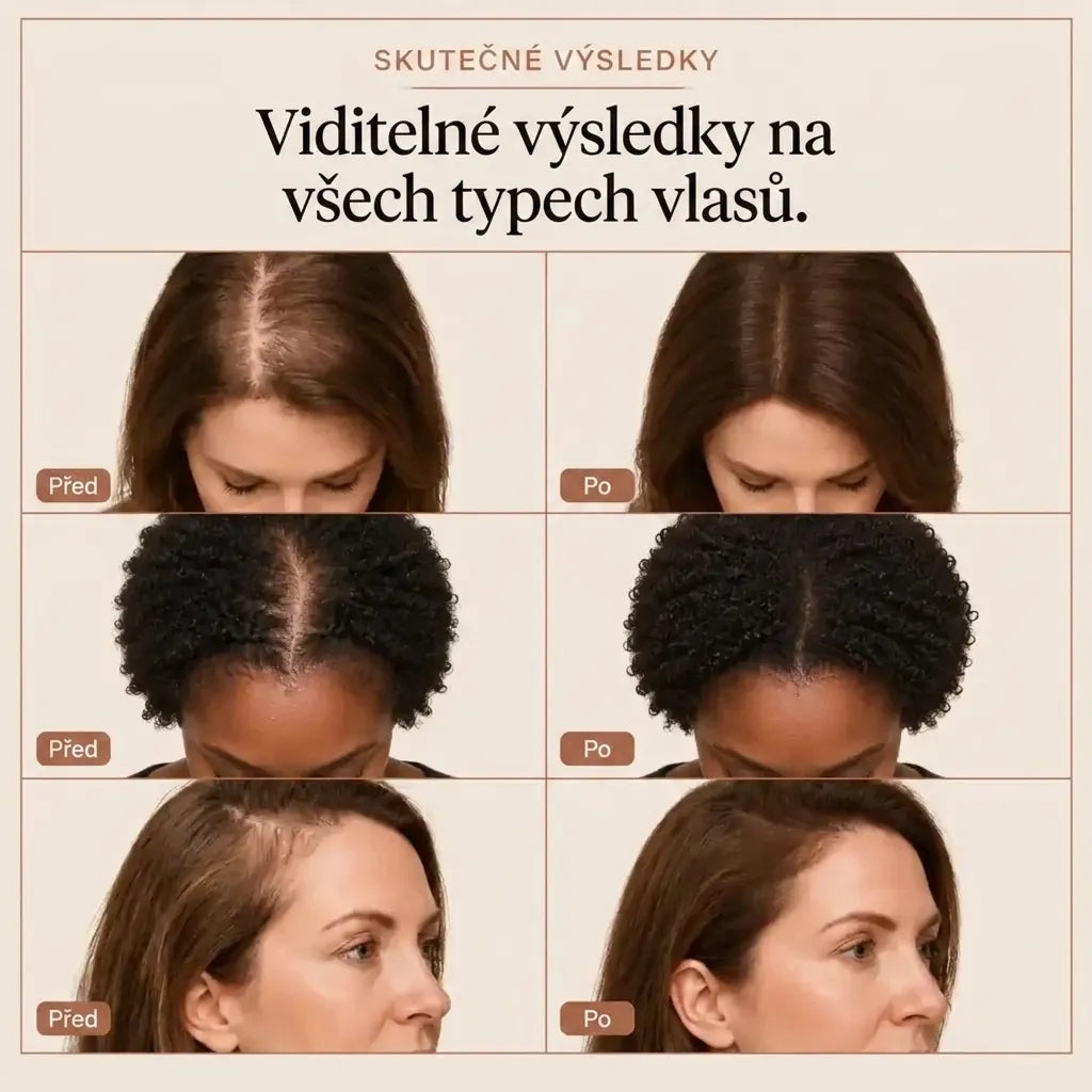 Vlasové sérum Lyrenia