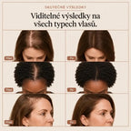 Vlasové sérum Lyrenia