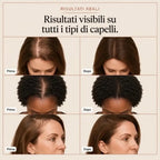 Siero Capillare myRiya