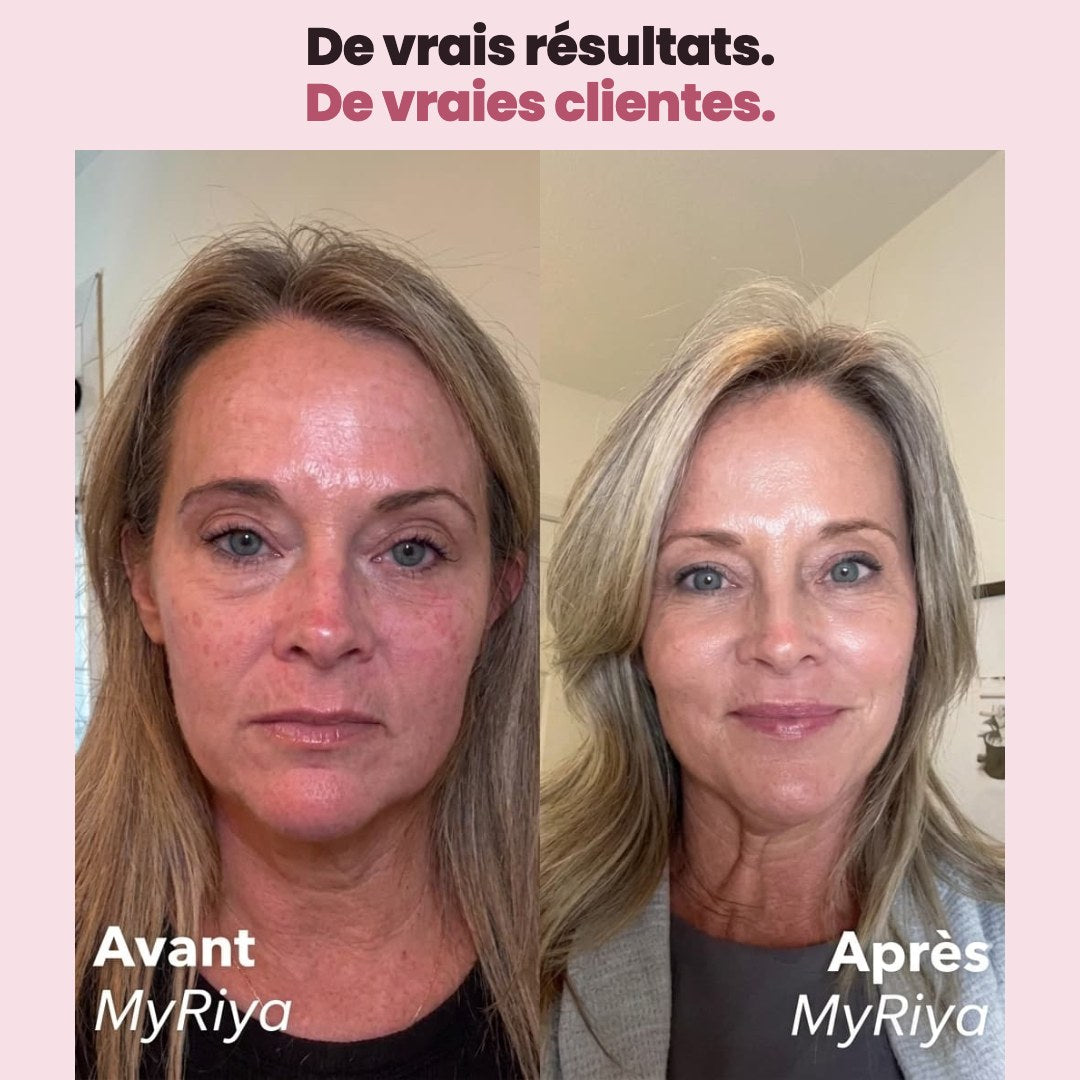 Avant / après d'une cliente myRiya